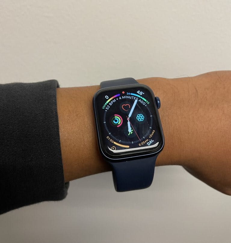 Apple Watch on Bennys Wrist